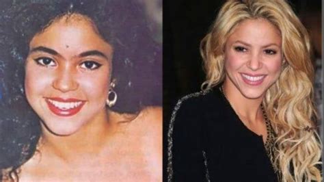 shakira before and after plastic surgery